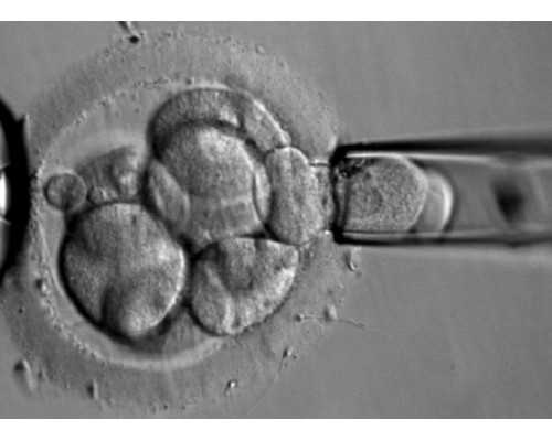 温州试管婴儿医院咨询电话号码_贵阳哪家医院做试管婴好成功率高费用也不高~代妈补偿表