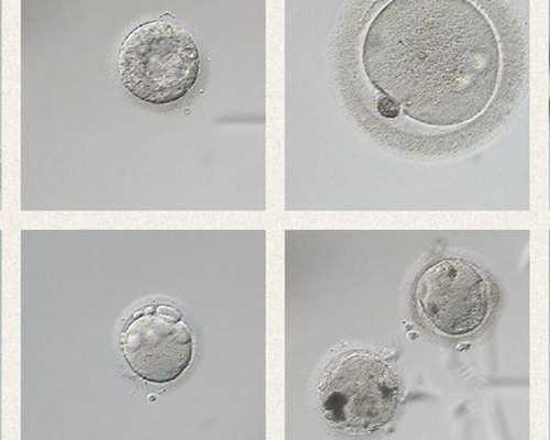 武汉专业供卵机构,武汉供卵试管机构(武汉最大供卵机构)