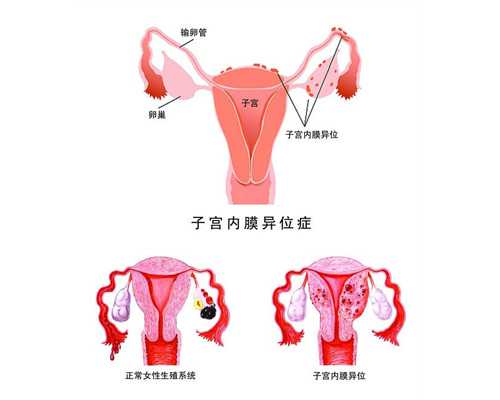 武汉代生全包,武汉供卵助孕公司短租,武汉春晖供卵