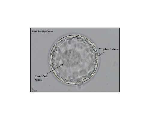 武汉哪家医院可以检查男性不育？检查费用大概要多少钱？
