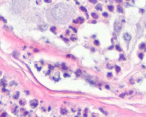 武汉咨询代孕公司,武汉精子库所在地,武汉人类精子库