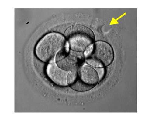 移植后吃基围虾有什么好处？冻胚移植后可不可以吃基围虾？~专业供卵代生