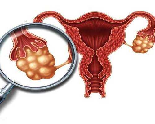 武汉做试管婴儿大概需要多少钱?,在武汉做一次试管婴儿多少钱