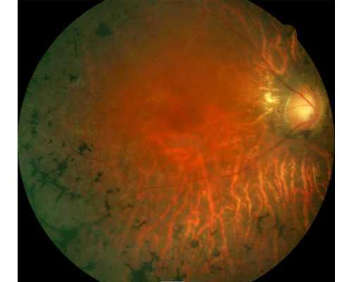 受精卵着床成功有哪些表现