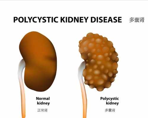 <strong>幼稚子宫怎么区分是先天性还是后天性的？~助孕公司价格</strong>
