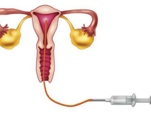 贵州试管婴儿做一次多少钱？~代生代怀费用