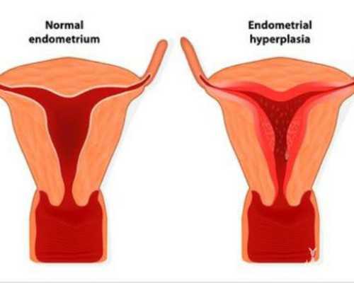 武汉买卵子,武汉正规供卵试管医院,武汉正规供卵机构