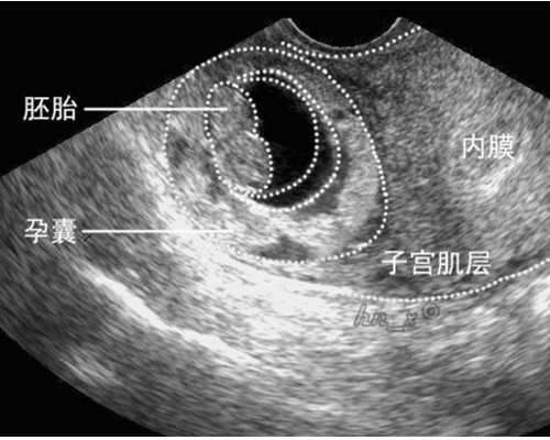 贵州试管私人机构怎么选-贵州有做试管婴儿医院！