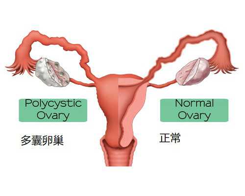 贵州试管婴儿何时纳入医保？贵州三代试管生男孩费用？