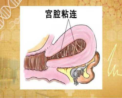 武汉包男孩代孕套餐,武汉哪里有供卵机构,武汉哪里有捐卵机构