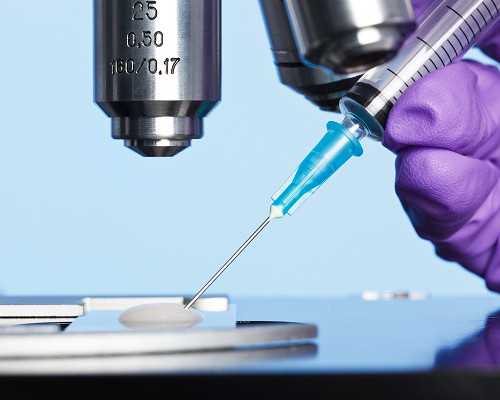 武汉供卵捐卵,武汉捐卵乱象调查