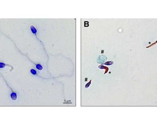 纵隔子宫生孩子必须要剖腹产?~~供卵包男孩价格