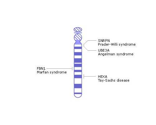 怀孕初期胎心停止有什么症状