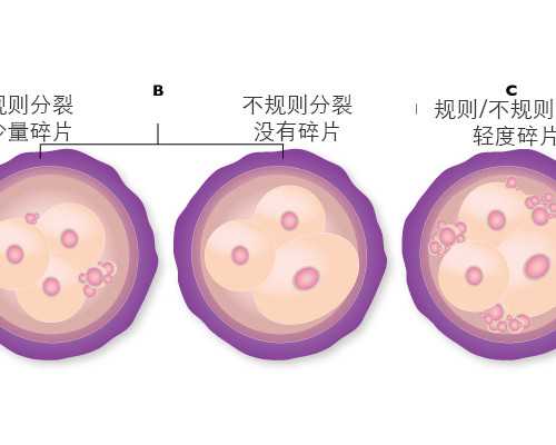 卵巢早衰吃些什么可以保养？6种食物多吃让你卵巢回春