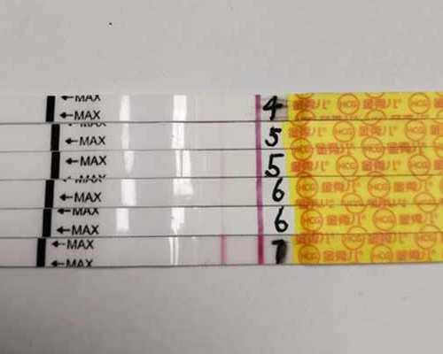 囊性结构是孕囊吗~~人工代怀